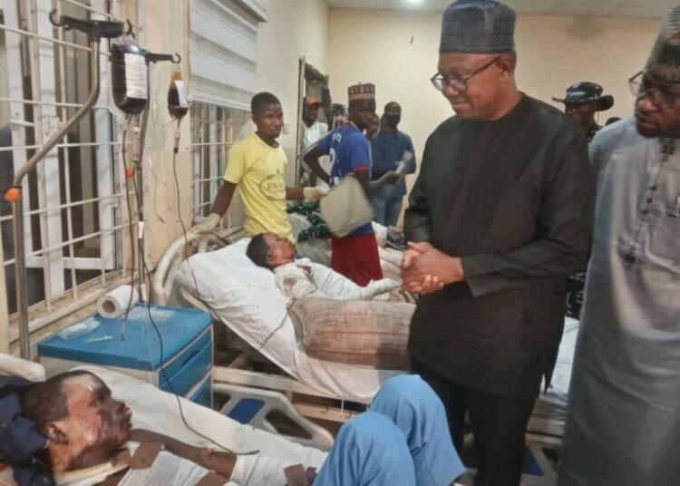 Village Boy Movement vs City Boy Movement